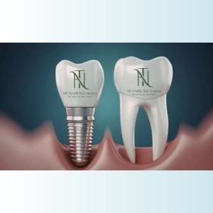 מרפאות שיניים בזכרון יעקב