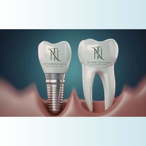 מרפאות שיניים בזכרון יעקב