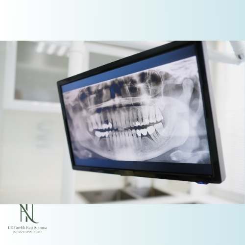 מרפאות שיניים בזכרון יעקב