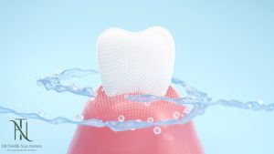 השתלת שיניים ביום אחד בזכרון יעקב