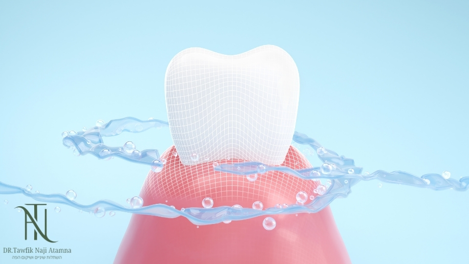 השתלת שיניים ביום אחד בזכרון יעקב