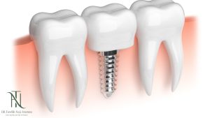 מרפאות שיניים בזכרון יעקב